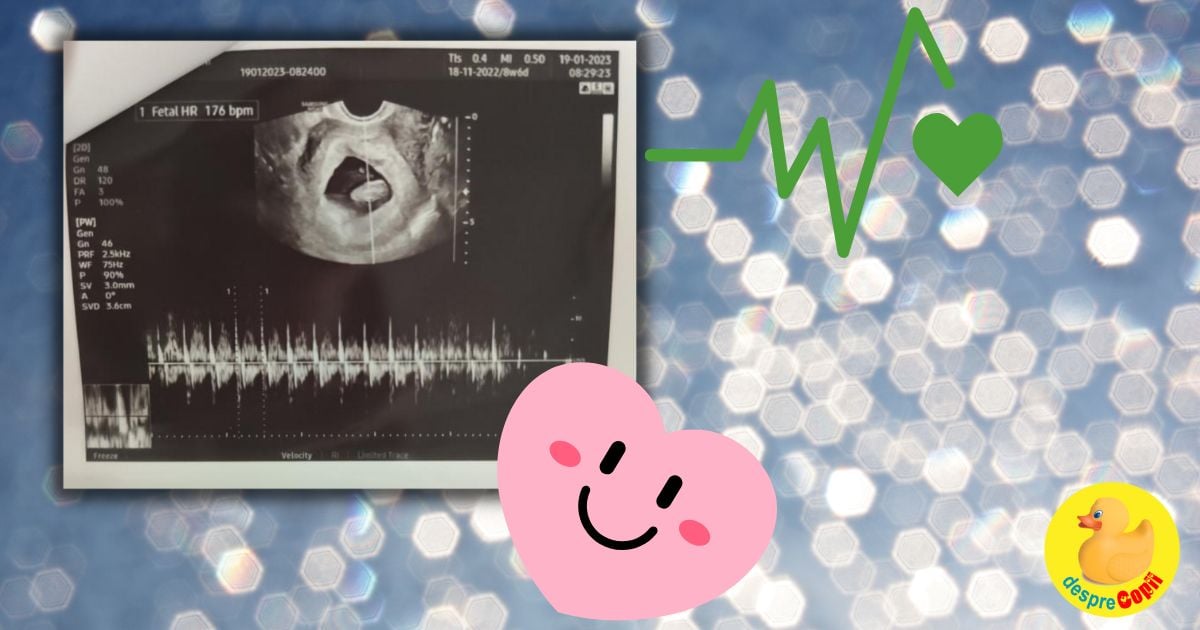 Saptamana 8 si emotiile primei ecografii - jurnal de sarcina width=