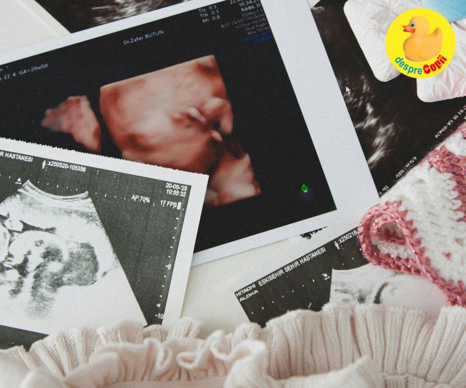 Prima ecografie a fost un dezastru cu final fericit - jurnal de sarcină