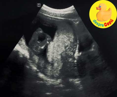 Lucrurile devin serioase: primul control si verdictul testelor babesti - jurnal de sarcina