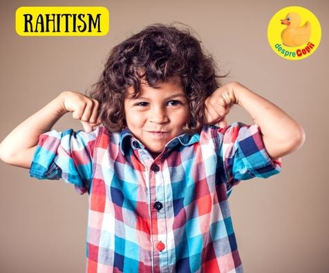 Rahitismul la copil: cand apare si cum se trateaza - sfatul medicului pediatru