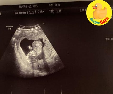 La 15 săptămâni aflu că placenta este inserată jos - jurnal de sarcină