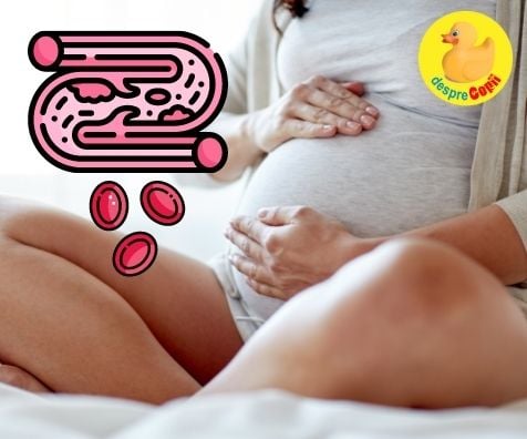 Trombofilia in timpul sarcinii: o complicatie a sarcinii - acestea sunt situatiile riscante