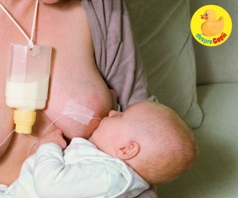 Sistemul de Nutritie Suplimentara - cand mami nu reuseste sa tina pasul cu foamea lui bebe