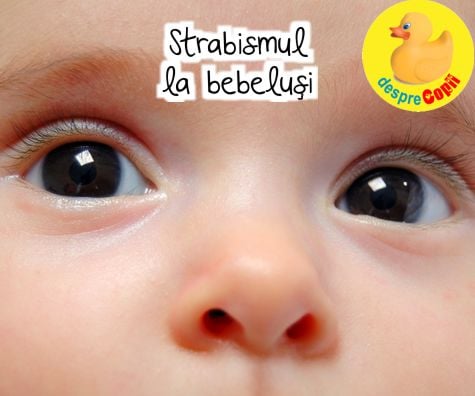 Strabismul la bebelusi