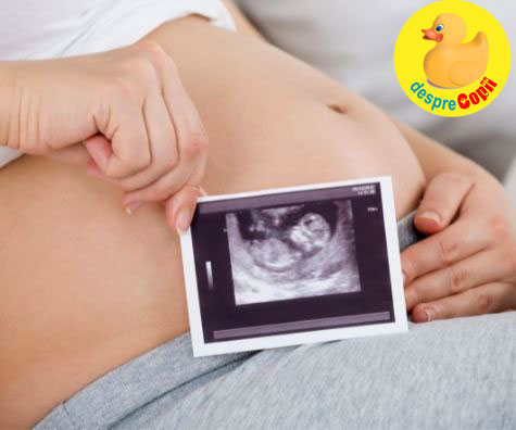 Morfologia fetala din trimestrul 2 -  o zi plina de emotii dar si temeri - jurnal de sarcina