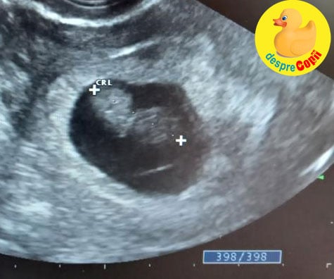 Triplul test in saptamana 16 de sarcina: experienta mea - jurnal de sarcina